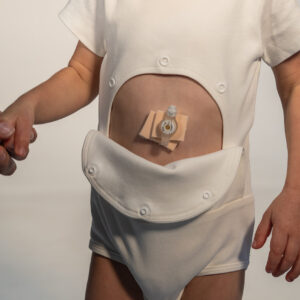 Adaptive Short Sleeve Bodysuit